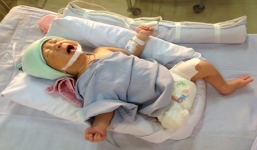 Bác sĩ kể lại phút 'nín thở' cứu bé trai văng khỏi bụng mẹ