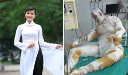 Thiếu nữ xinh đẹp cho 'thuê thân' để kêu gọi giúp đỡ cô gái Thanh Hóa bị bỏng