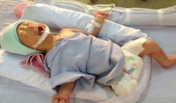 Thông tin mới nhất về sức khỏe bé sơ sinh văng ra khỏi bụng mẹ