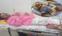 Vụ bé sơ sinh văng khỏi bụng mẹ: Xe bồn không bấm còi gây tai nạn 