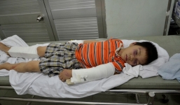 Bé trai 6 tuổi bị người tình của mẹ đánh gãy chân tay