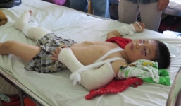 Vụ bé 6 tuổi bị hành hạ: 'Ba dượng dùng gậy gỗ đánh từ sáng đến tối'