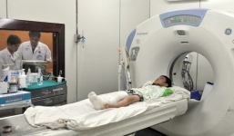 Lời khai 'thú tính' của cha dượng đánh con gãy 2 tay 1 chân, nứt sọ