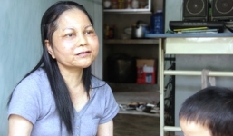 Thăm 'thiếu nữ hóa bà già' sau khi điều trị ở Đài Loan