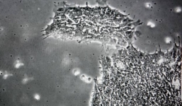 Phát hiện virus khiến “con người trở nên ngu ngốc hơn”