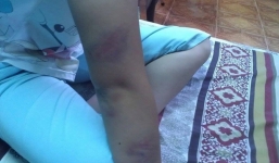 Lời kêu cứu của cô gái bị cha mẹ bạo hành ngăn cản vì... yêu thầy