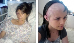 Nữ sinh bị u não vẫn tốt nghiệp đại học loại ưu