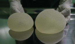 Thiếu nữ Trung Quốc phẫu thuật nâng ngực để kiếm chồng