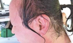 Nữ sinh viên hắt nước sôi vào mặt giáo sư vì không được điểm danh