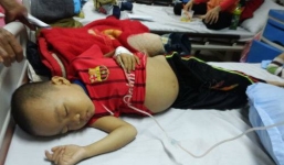 Xót xa bé trai mắc bệnh huyết tán nguy kịch bị cha mẹ ruồng bỏ