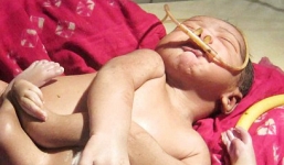 Hàng nghìn người Ấn Độ đổ xô đi xem cậu bé có 8 chân tay