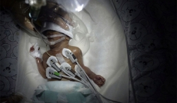 Sức sống thần kỳ của bé sơ sinh chỉ nặng 660g