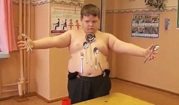 Sau tai nạn điện giật, cậu bé hút đồ vật như nam châm