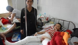 Bé trai bỏng nặng sau hình phạt 'đốt rơm': người cha bị 'thần kinh tái phát'