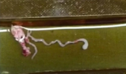 Kinh hãi giun dài 8cm ký sinh trong não người