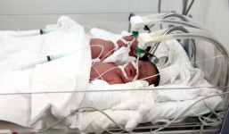 Ca điều trị hiếm muộn sinh 3 bé trai, 1 bé gái hiếm gặp trong 30 năm