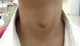 Bé trai 7 tuổi ngừng tim vì trò nghịch dại của bạn