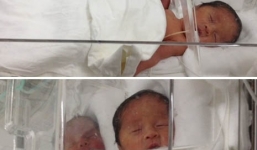 Hi hữu ca sinh tư ở Hà Nội: Hành trình vượt cạn của sản phụ trẻ