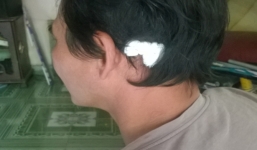 Cảnh khốn cùng gia đình 4 người bị hành hung vì nợ 500 ngàn đồng