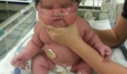 Bé gái chào đời đã nặng gần 7kg