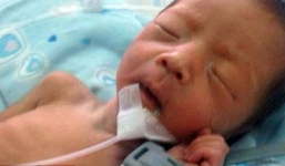 Bé sinh non sống sót kỳ diệu sau khi bị chôn sống