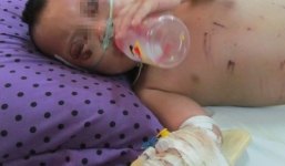 Bé 2 tuổi bị bà ngoại đánh: Tâm sự thắt lòng của người mẹ