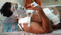 Chủ hãng nước đá bị tạt axít trong lúc ăn sáng