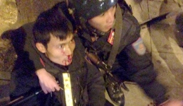 Chặn đoàn đua xe, chiến sỹ Cảnh sát cơ động bị đâm gãy chân