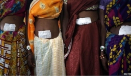 Bác sĩ say rượu đi ngủ, bỏ mặc bệnh nhân đã gây mê chờ mổ