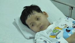 Bé trai 7 tuổi nghi bị mẹ tiêm thuốc diệt cỏ xuất viện