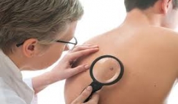 Top 7 nguyên nhân hàng đầu gây bệnh ung thư năm 2014