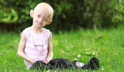 Hình ảnh xót lòng về cô bé 11 tuổi sống trong hình hài bà lão 80