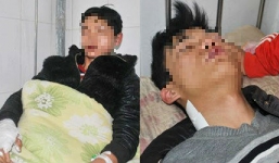 Hồ sơ đầy 'vết' của các nạn nhân bị đánh vì nghi trộm chó