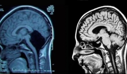 Top những căn bệnh khiến y học bó tay năm 2014