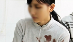 Nổ cây xăng tại Sóc Trăng: Lời kể kinh hoàng của nạn nhân