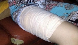 Xuất hiện kẻ lạ mặt dùng vật nhọn tấn công nữ sinh ở Long An