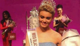 'Cô gái da rắn' mắc bệnh eczema  đăng quang Hoa hậu