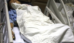 Cứu cô gái 17 tuổi vỡ bụng nghi do thuốc nổ