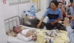 Hút thuốc khi đang rút xăng xe, nam thanh niên bỏng nặng