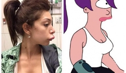 Người đẹp có môi sưng phồng như mỏ vịt vì PTTM hỏng