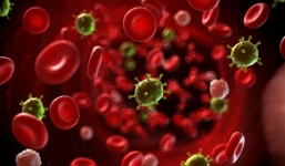 Tìm hiểu bệnh rối loạn sinh tủy ông Nguyễn Bá Thanh mắc phải