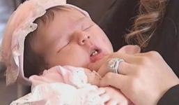 Bé gái vừa chào đời đã có hai răng cửa hoàn chỉnh