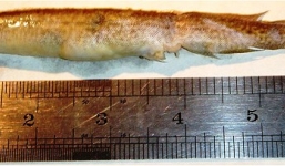 Con lươn sống dài 6cm mắc kẹt trong cổ họng cậu bé