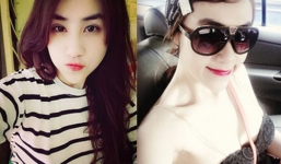 Cận cảnh nhan sắc cô gái Sài thành 9 lần 'dao kéo' đau đớn