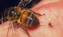 Người đàn ông nguy kịch vì bị ong đốt gần 300 mũi