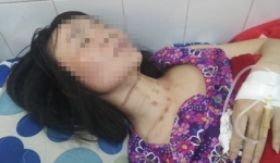 Chủ quán cà phê kể lại giây phút đối mặt với tên cướp