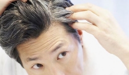 4 nguyên nhân khiến tóc bạc trước tuổi 30