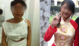 Nữ sinh xinh đẹp buồn tủi với khuôn mặt biến dạng vì bệnh quái ác