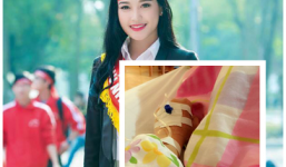 Á hậu Huyền My bất ngờ nhập viện sau scandal tình cảm 