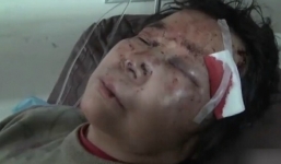 Trung Quốc: Xin được nhường đường, cụ bà 68 tuổi bị đánh đến nhập viện